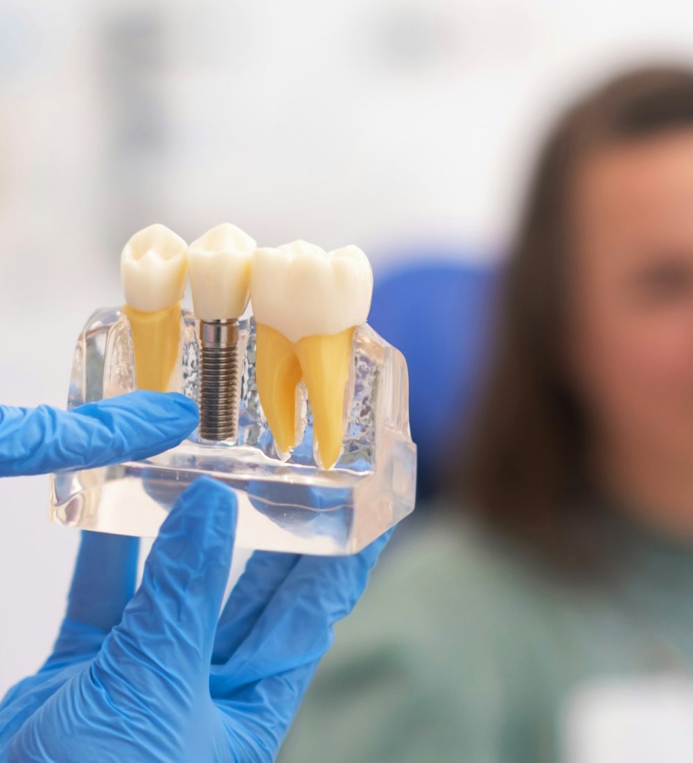 dental implants, dentist discussing a treatment plan with patient holds a dental implant model